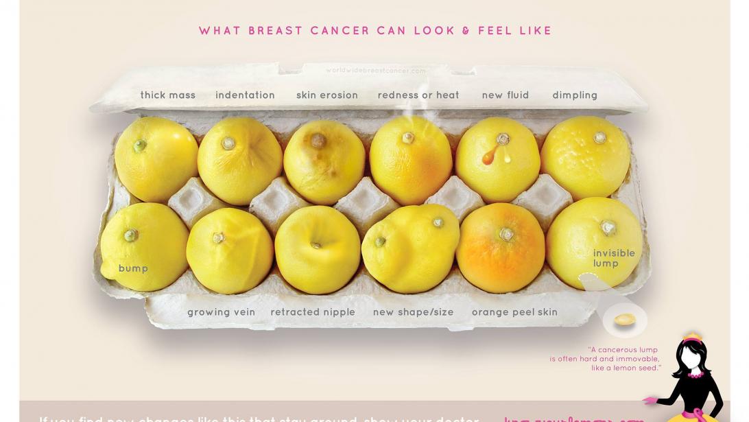 Des citrons pour dépister plus facilement le cancer du sein Des citrons pour dépister plus facilement le cancer du sein