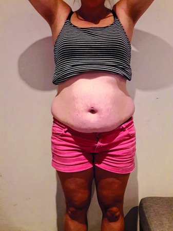 Sophie, 28 ans, a accouché il y a 3 mois