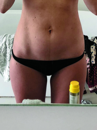 Élisabeth, 36 ans, a accouché il y a 5 mois