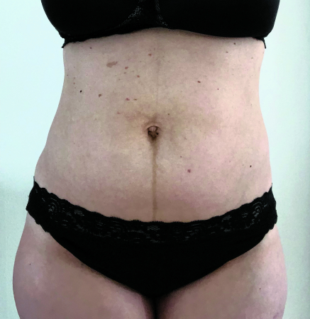 Nele, 36 ans, a accouché il y a 4 mois
