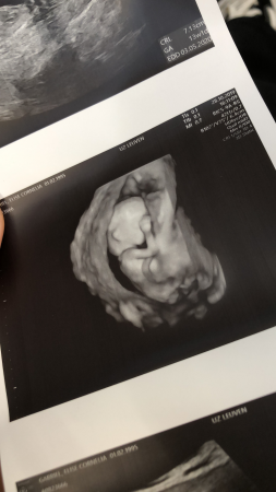 Hello, baby