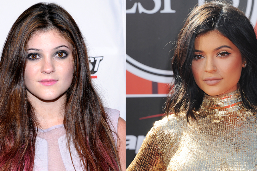 KARDASHIAN le chirurgien se confie sur leurs transformations