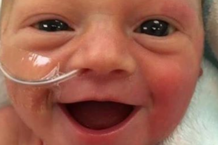 Premature A 6 Mois Ce Bebe Offre Un Sourire Plein D Espoir A Sa Maman