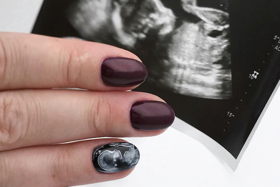 Ultrasound Nails De Nieuwe Manicuretrend Bij Zwangere Vrouwen