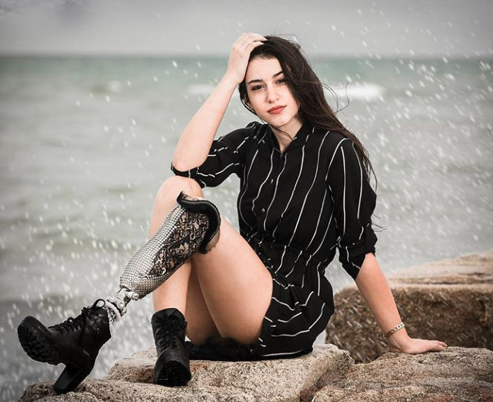 Amputée Dune Jambe Elle Devient Finaliste De Miss Italie 