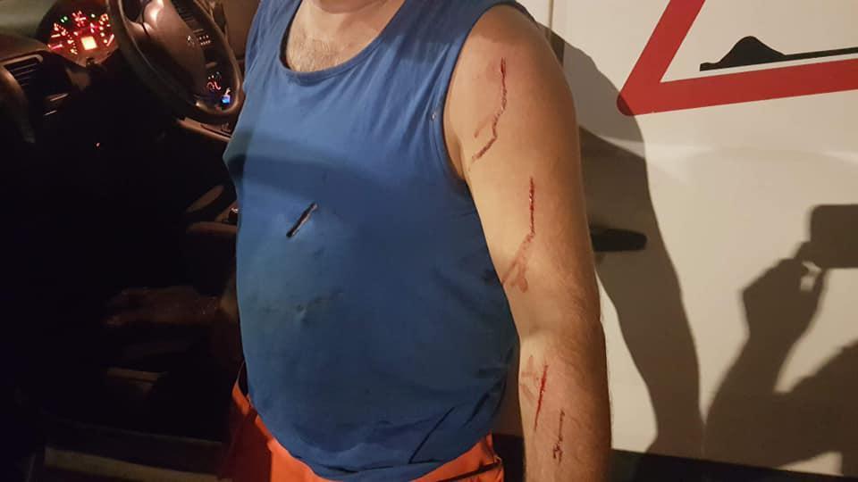 Arbeider in havengebied met breekmessen aangevallen door transmigranten