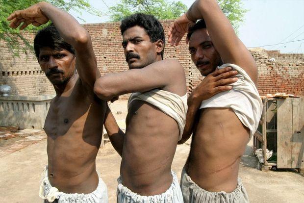 Deze drie Pakistaanse mannen verkochten elk een nier uit armoede, 2006 
