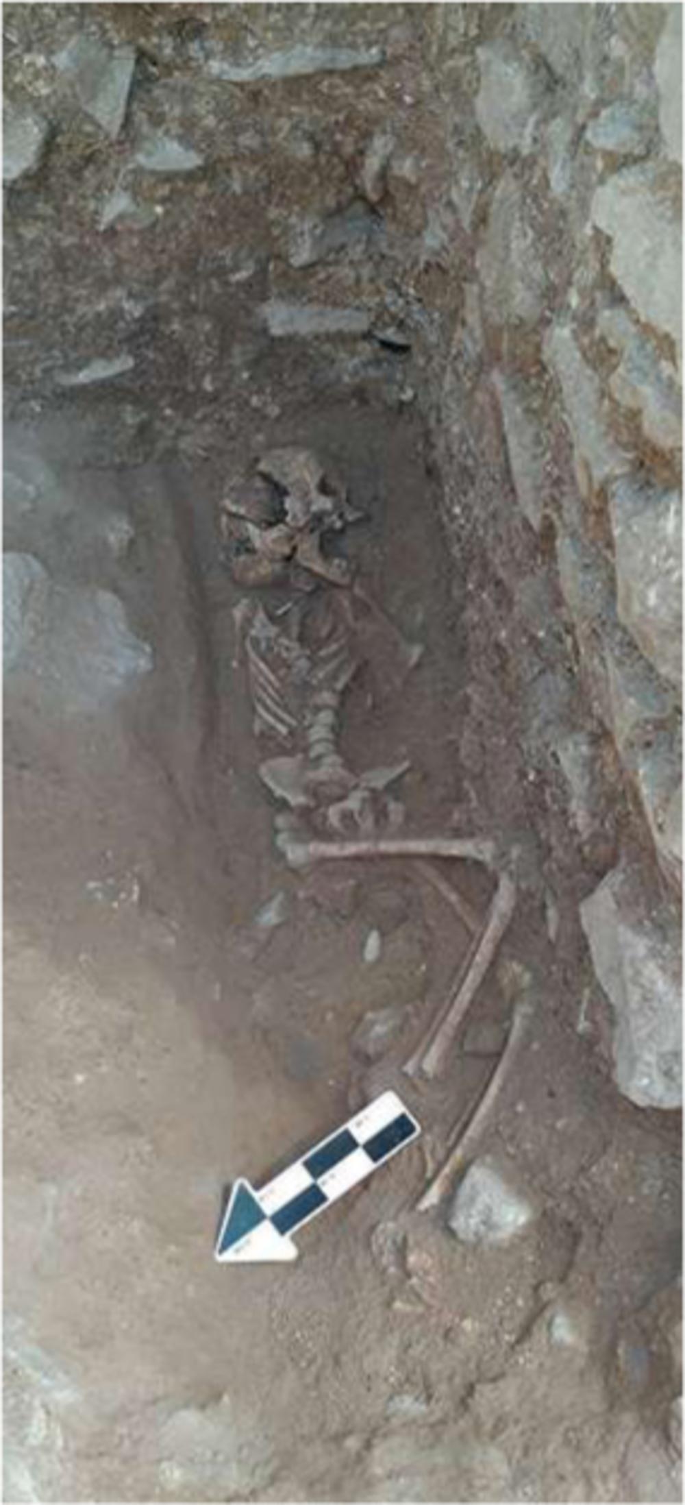 Het skelet van het tienjarige kind.