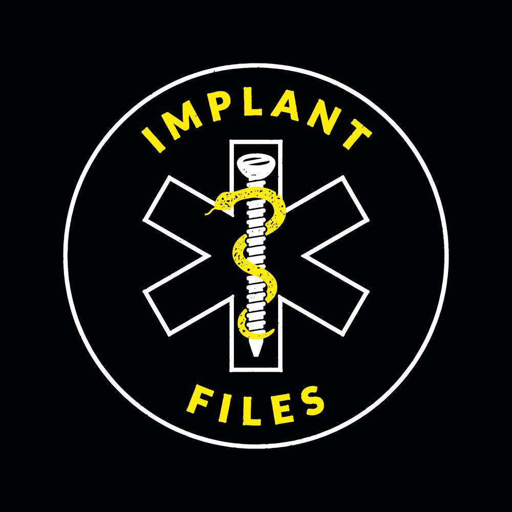 De Implant Files