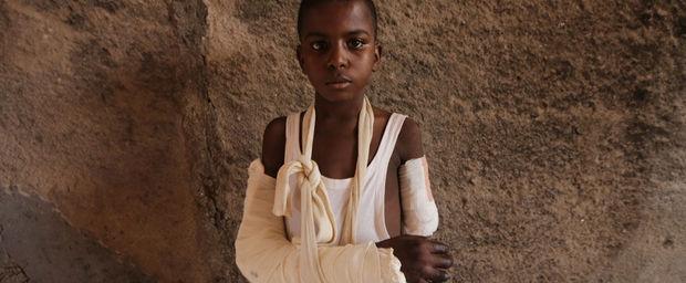 Mamoudou, 12, werd met machetes aangevallen door anti-balaka-strijders in Bossemptele en voor dood achtergelaten. Hij verloord zijn linkerarm.