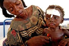 Niger: een moeder verzorgt haar kind dat volledig ondervoed is. 