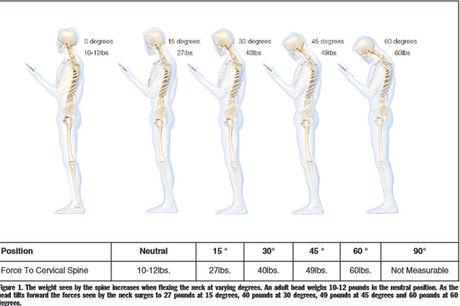 Het gewicht van ons hoofd op de nek: van 12,3 kg bij 15°, 18,2 kg bij 30°, 22,3 kg bij 45° tot 27,3 kg bij 60°.