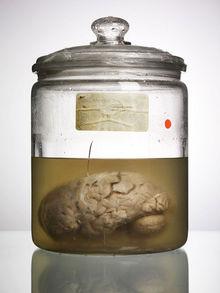 De Amerikaanse fotograaf Adam Voorhes fotografeerde de hersenen voor zijn boek 'Malformed: Forgotten Brains of the Texas State Mental Hospital'.
