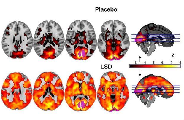 Le LSD rend le cerveau plus 