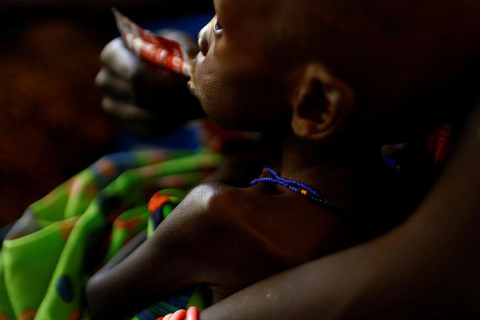 Une mère nourrit son enfant avec une pâte de noisette après avoir été diagnostiqué de sévère malnutrition dans un hopital de l'UNICEF dans la capitale du Sud Soudan, Juba. 