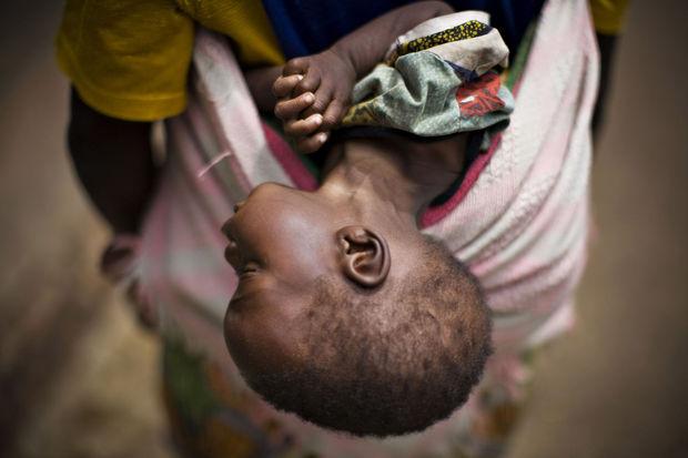 Een vrouw draagt haar ernstig ondervoed kind aan een missiepost in Goma, Congo. 