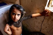 Dans un village d'Irak, la vie d'Haoura, fillette mise au ban à cause d'une maladie congénitale