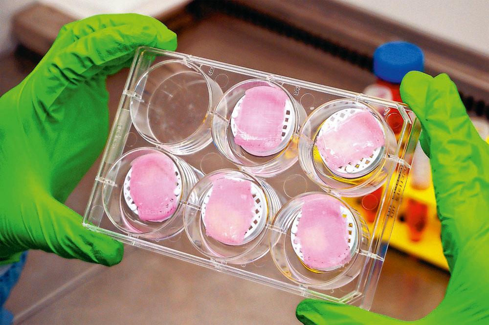 La start-up bordelaise Poietis a conçu les tout premiers échantillons de peau bio-imprimée.