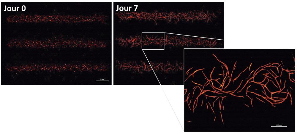 Des veines fonctionnelles de différentes tailles apparaissent en quelques jours, une fois les cellules souches déposées par laser selon un motif précis.