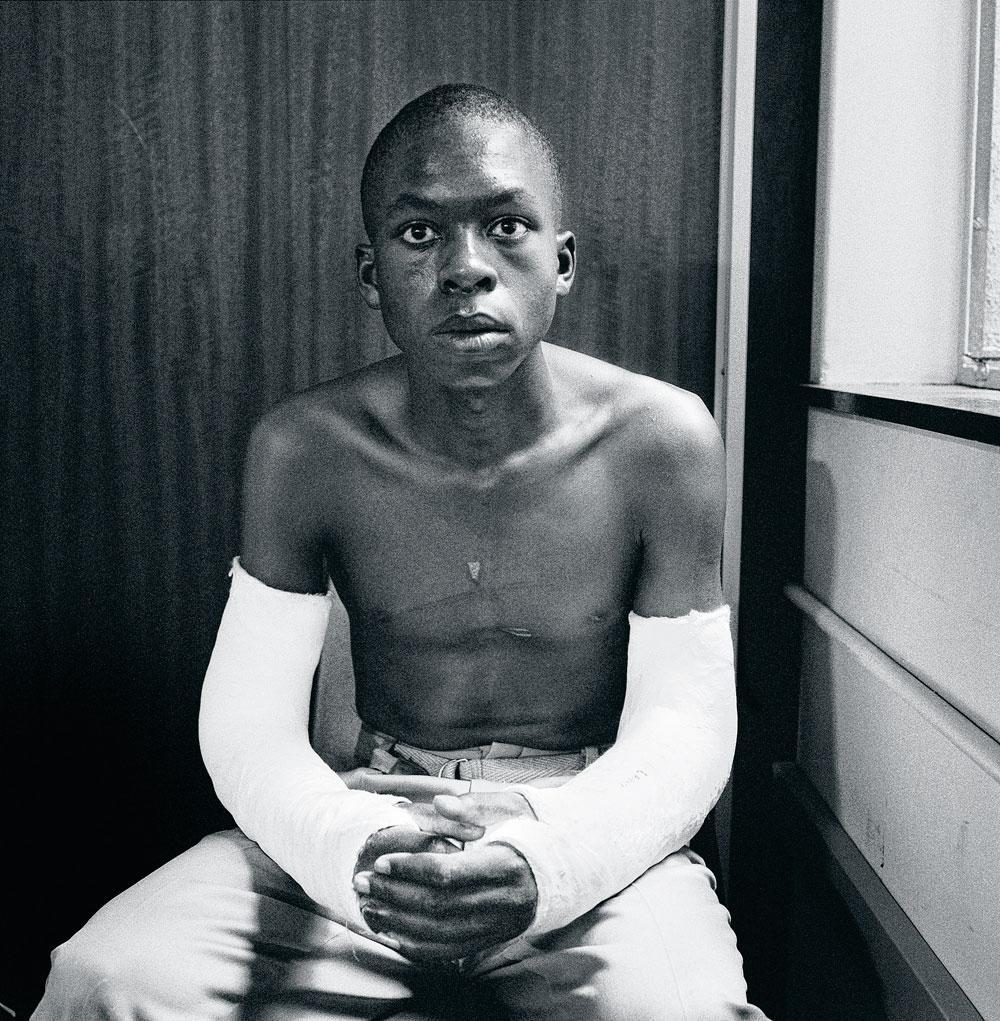 Lawrence Matjee, 15 ans, après son agression et sa détention par la police de sécurité, Khotso House, rue  de Villiers, Johannesbourg, 1985.