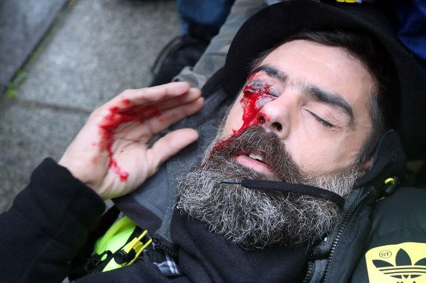 Jerome Rodrigues, à terre, blessé à l'oeil par les forces de l'ordre