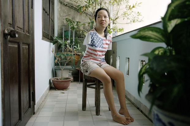 Thuy Linh est issue de la troisième génération de victimes de l'Agent orange souffrant de malformation génétique ; née sans bras. Hô Chi Minh-Ville, Viêtnam. 2015