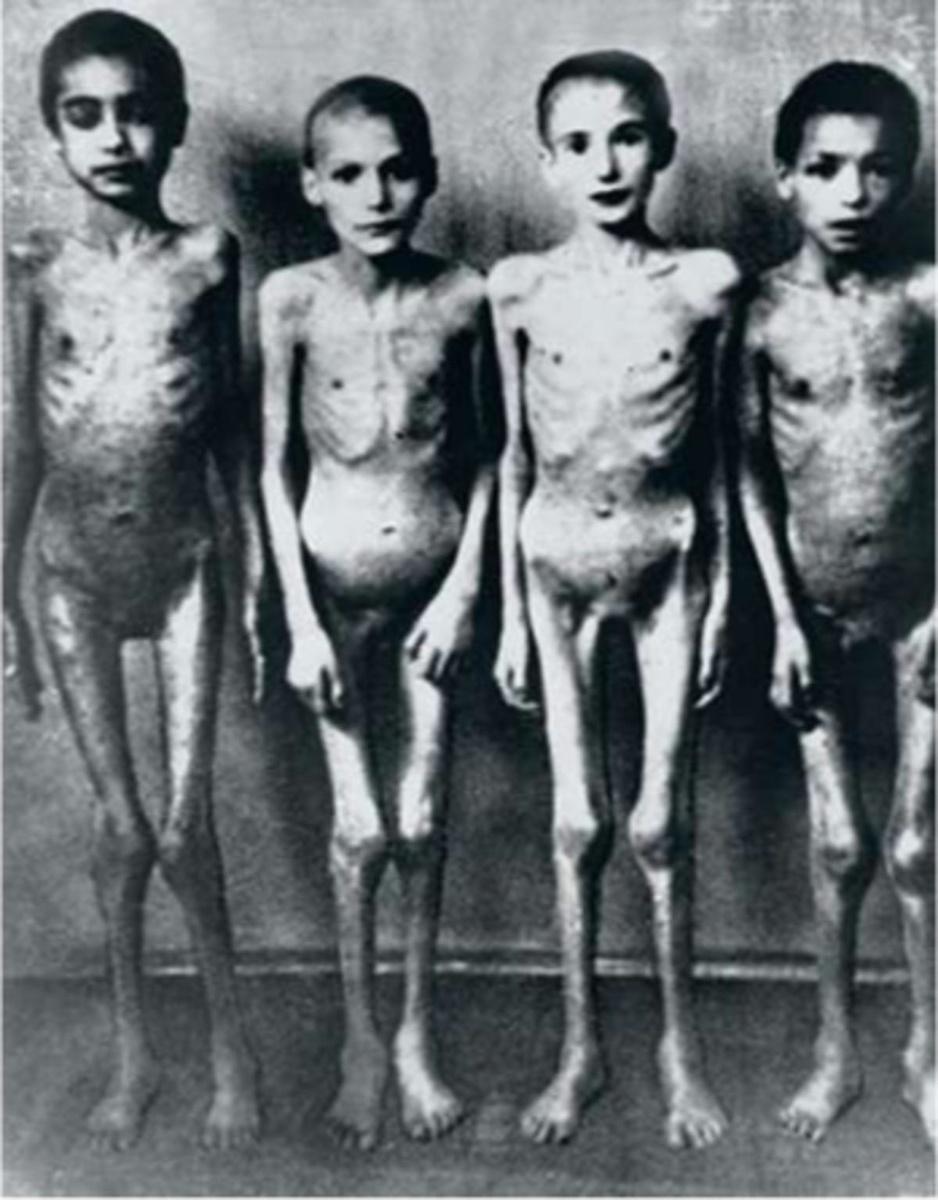 A Auschwitz, ces enfants ont été victimes des expérimentations menées par Joseph Mengele.