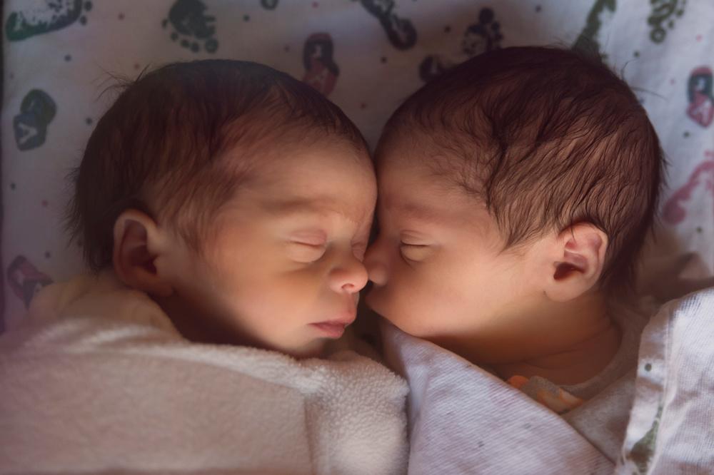 Un boom sans précédent de jumeaux dans le monde