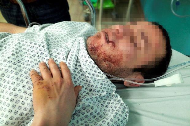 Een van de slachtoffers van de aanval door drie mannen, in een ziekenhuis in Calais.