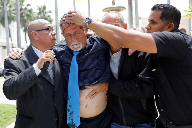 Americo De Grazia wordt weggedragen nadat hij werd aangevallen door sympathisanten van de Venezolaanse president Nicolas Maduro, 5 juli 2017.