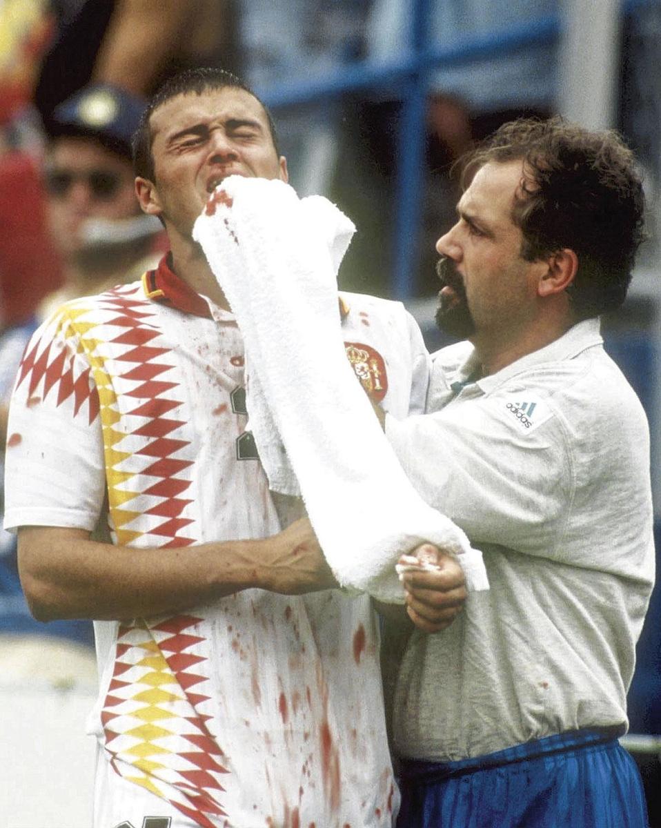 Luis Enrique le nez en sang (et cassé...), lors du quart de finale du Mondial 94 contre... l'Italie.