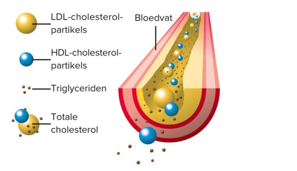 Meten is weten: wanneer moet je je cholesterol laten bepalen?