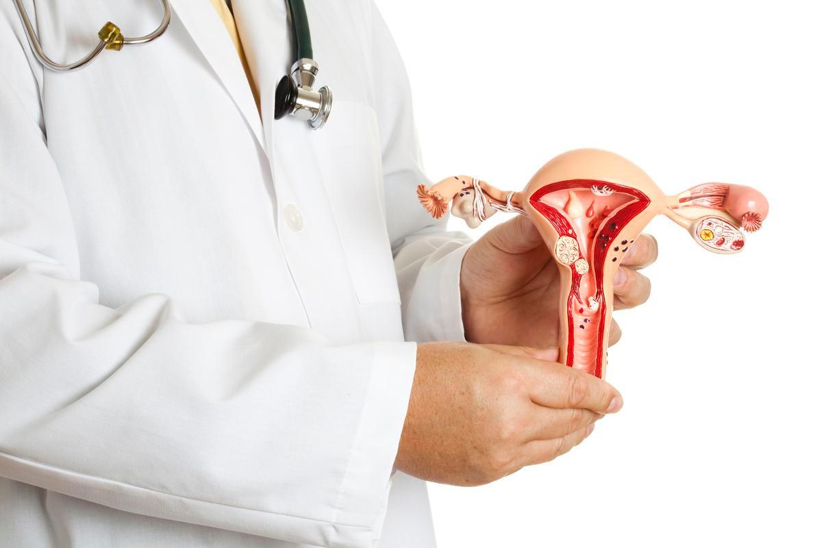 Baarmoederfibromen: hoe behandel je ze?