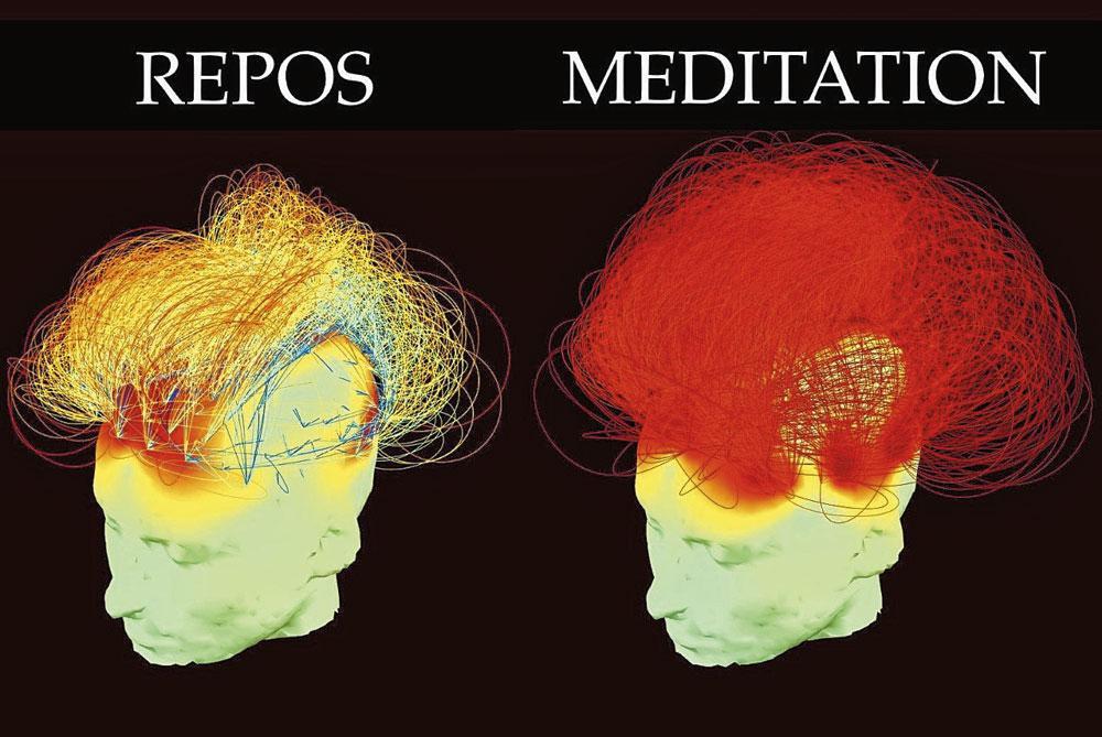 L'imagerie médicale prouve que la méditation stimule certaines zones du cerveau.