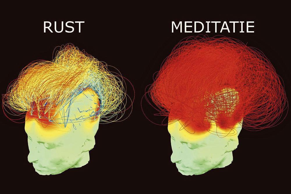 Via medische beeldvorming kon worden aangetoond dat meditatie bepaalde delen van de hersenen stimuleert.