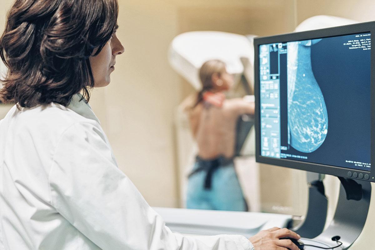 Tussen 50 en 69 hebben vrouwen recht op een mammografie die borstkanker opspoort.