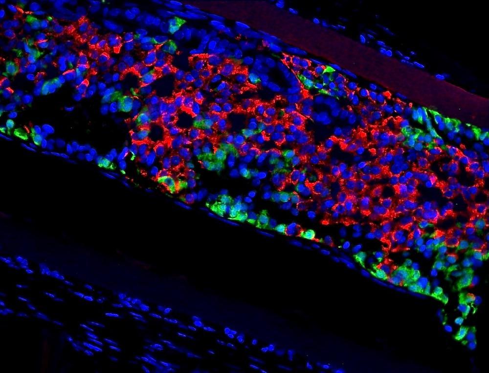 Preklinische studie toont vorming van insuline-producerende beta-cellen (in het rood) en andere endocriene cellen in een subcutaan getransplanteerde capsule met humane pancreas progenitorcellen, afgeleid van humane stamcellen.