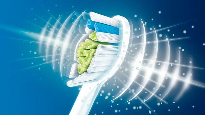 elektrische tandenborstel sonisch