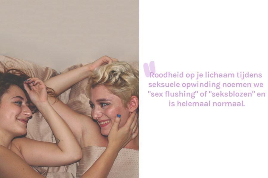Roodhuidje
