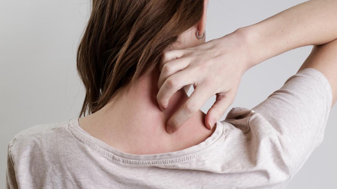 Symptômes, traitement: 5 questions que l'on se pose sur l'eczéma Symptômes, traitement: 5 questions que l'on se pose sur l'eczéma