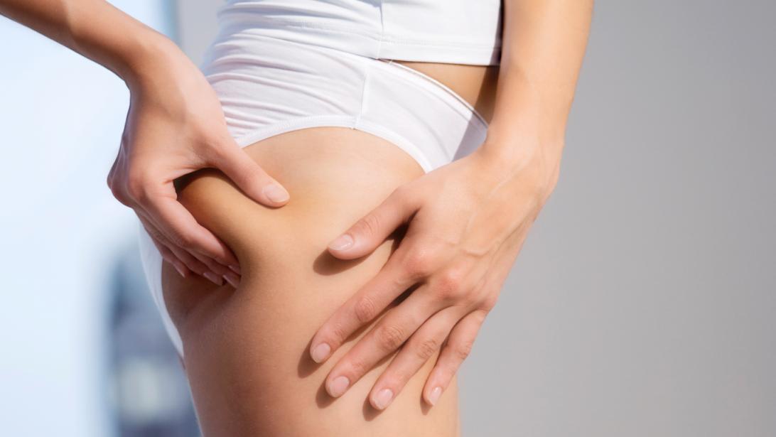 La boisson à zapper pour éviter la cellulite La boisson à zapper pour éviter la cellulite