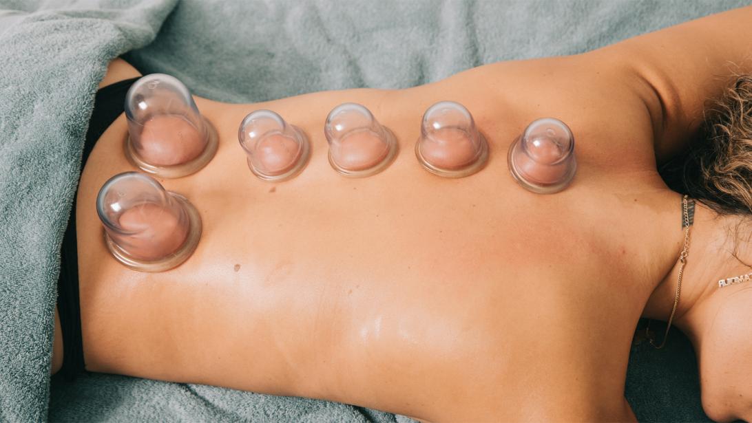 Onze redactrice deed aan 'cupping' en misschien is het ook wel iets voor jou Onze redactrice deed aan 'cupping' en misschien is het ook wel iets voor jou