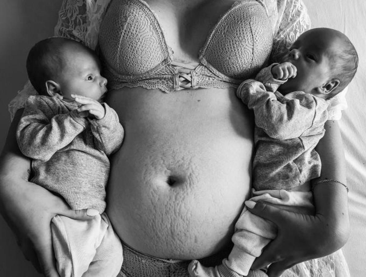 Post-partum