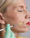 botox: qui consulter