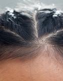 Baby hair