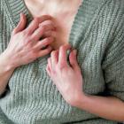 Vrouw met jeuk krabt aan hals.