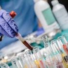 Stalen bloed worden onderzocht in een laboratorium/