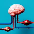 Conceptueel zwevend brein met pijpachtige slagaders en waarschuwingsbobbels die het risico op een beroerte aangeven