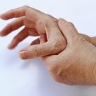 De handen van een vrouw met de ziekte van Parkinson beven.