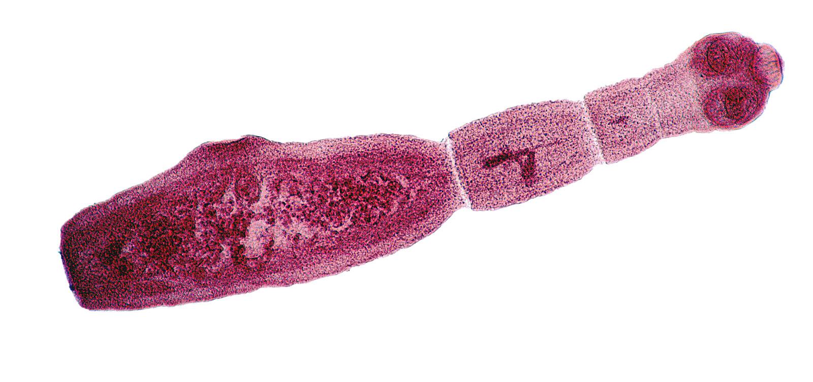 vossenlintworm